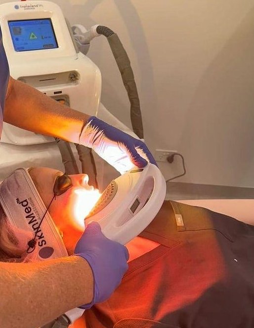 BBL and IPL skin rejuvenation treatment