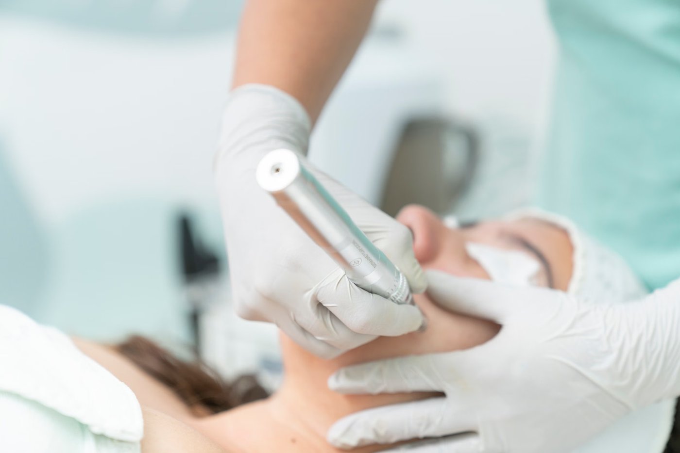 Microdermabrasion treatment (placeholder image)