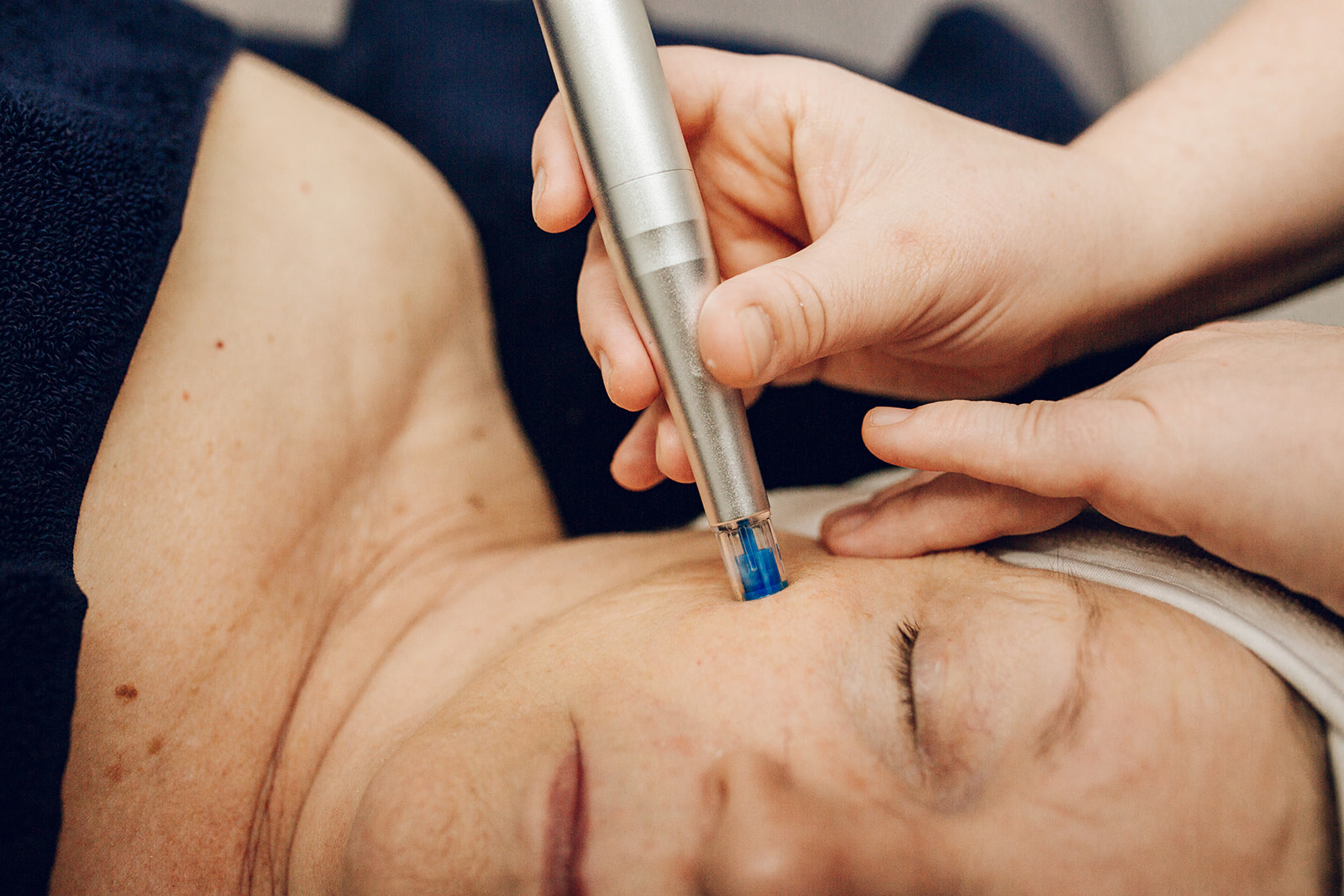 Skin Tight Nano-Facial with the Rezenerate skin wand